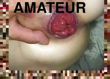 Anal dildo prolapse squirt big ass