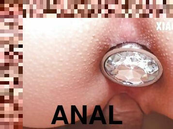 anal