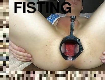 Anal dilator, Monster huge, huge dildo in the hole / ???????? ????? / ??????? / ???? / BDSM