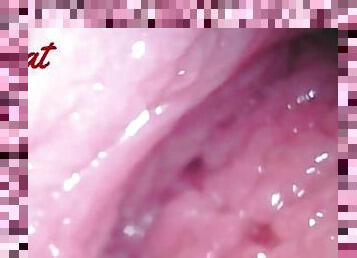 Endoscopic ?vaginal observation????????????